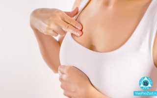Чешется грудь: причины и способы устранения зуда грудной железы