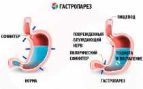 Порядок оказания первой помощи при гипогликемии