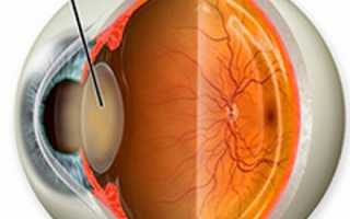 Капли от катаракты – инструкции и отзывы