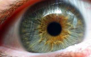 Меланоз глаз (меланопатия)