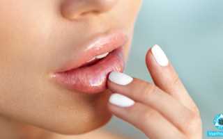 Почему чешутся губы, сохнут, трескаются, шелушатся: лечение