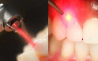 Как не бояться стоматолога: причины дентофобии